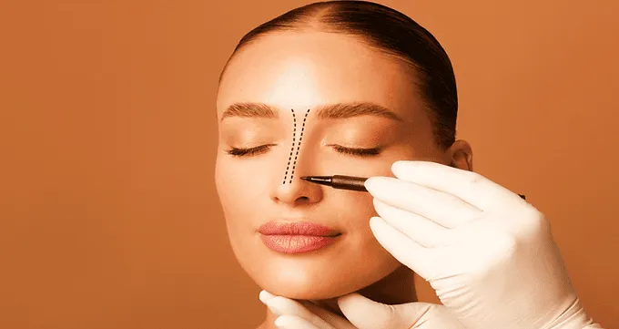 مراحل دریافت نوبت عمل بینی قسطی در اسلامشهر چگونه است؟