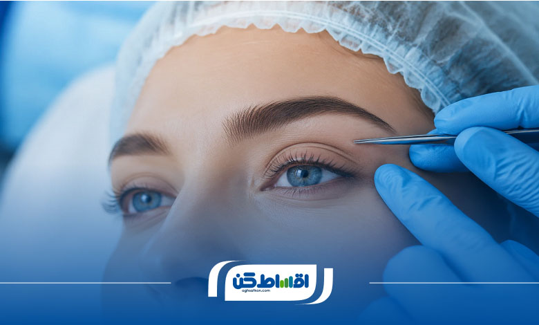 ماندگاری نتایج بلفاروپلاستی اقساطی چقدر است؟
