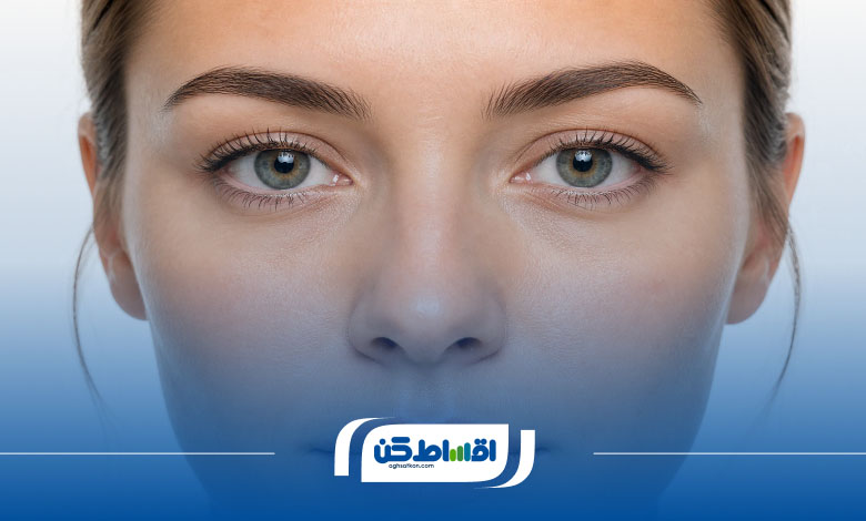آیا عمل بینی اقساطی در پرند به صرفه است؟