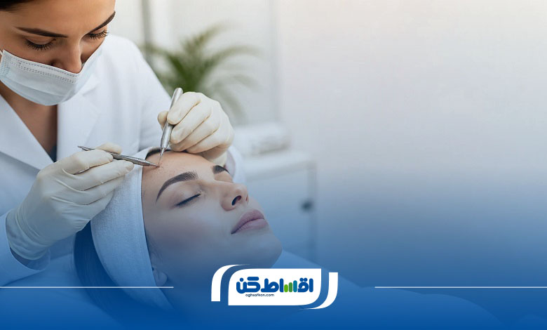 کاندیدای مناسب کاشت ابرو اقساطی