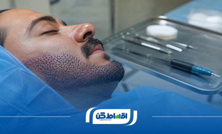 مشاوره قبل از کاشت ریش اقساطی
